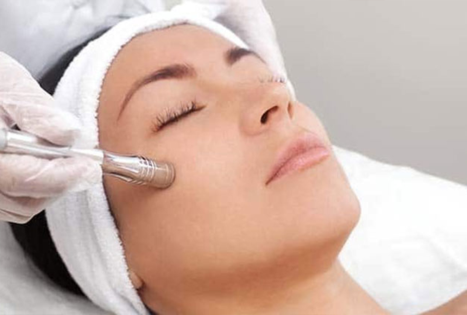 Tratamiento Dermapen  (microneedling) 